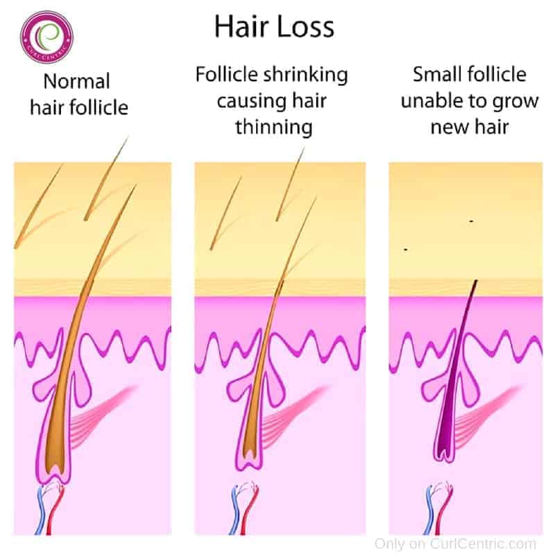 Curly Hair Loss: Stop Hair from Thinning and Shedding