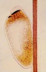 head louse egg or nit attached to hair shaft of human host