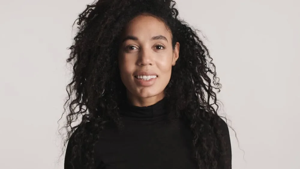 A young woman with hair shaft damage after using excessive heat styling tools (e.g., flat irons, curling irons, etc.).