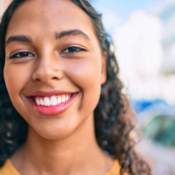 A young African American female with a thinning hairline on her 3A natural hair follicles wanted to thicken hair edges.